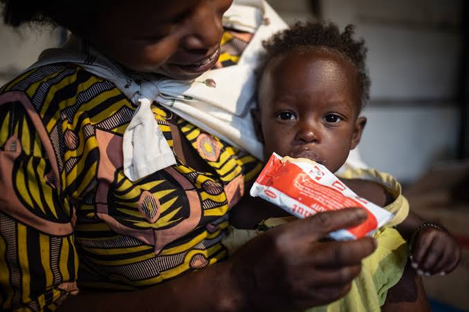 RDC : Plus de 48 % des enfants souffrent de malnutrition infantile dans les 26 provinces du pays entre 2024 et 2025.