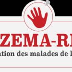 GOMA : Mieux vivre avec une maladie de peau – l’engagement solidaire de l’association ECZEMA RDC