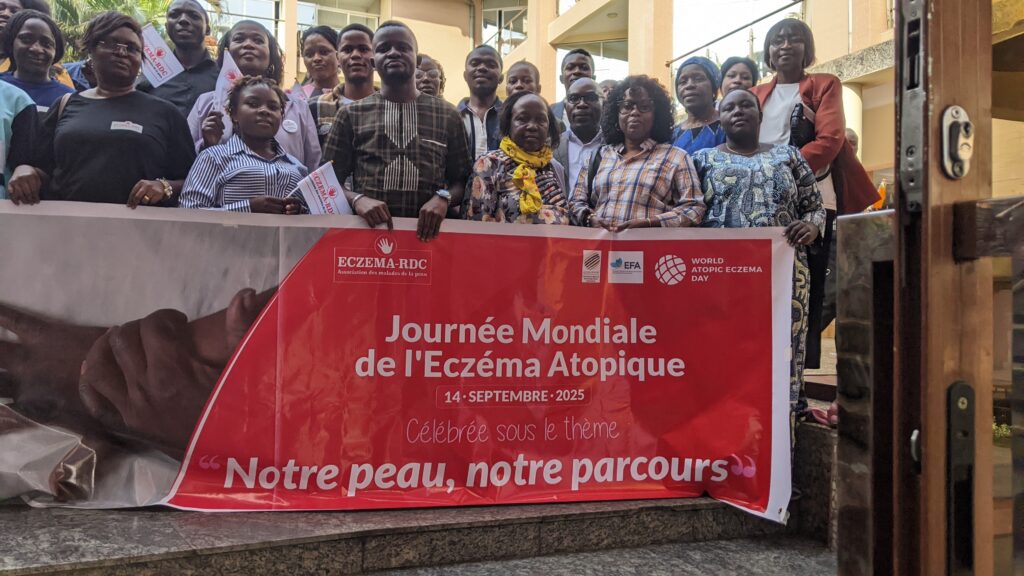 GOMA : ECZEMA atopique : malades, personnes vivantes avec les malades et médecins et spécialistes en dialogue à l’hôtel Linda