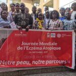 GOMA : ECZEMA atopique : malades, personnes vivantes avec les malades et médecins et spécialistes en dialogue à l’hôtel Linda